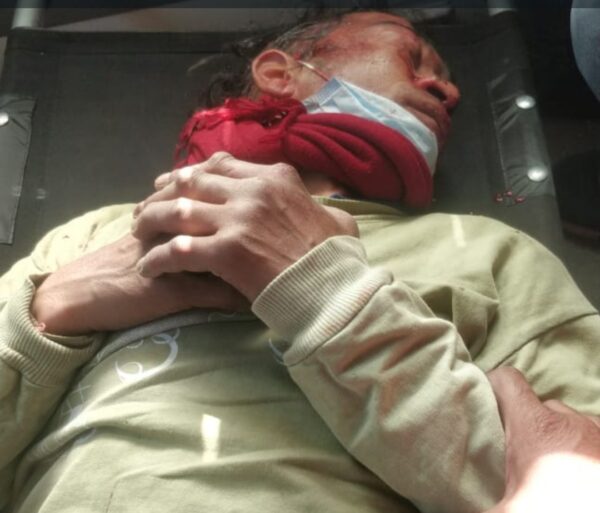 गुरु राम राय पौड़ी के एक चपरासी ने स्कूल की तीन मंज़िल छत से कूदकर किया आत्महत्या का प्रयास, मौत